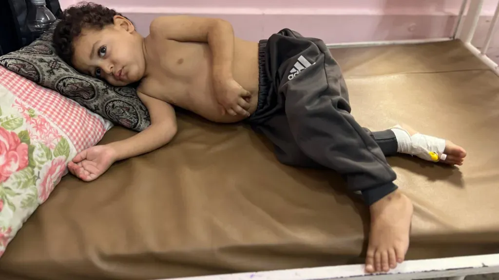 Gaza Children Die Waiting for Israeli Approval of Evacuations Amid Humanitarian Crisis 1 Gaza children dying as they wait for Israel to enable evacuations1
