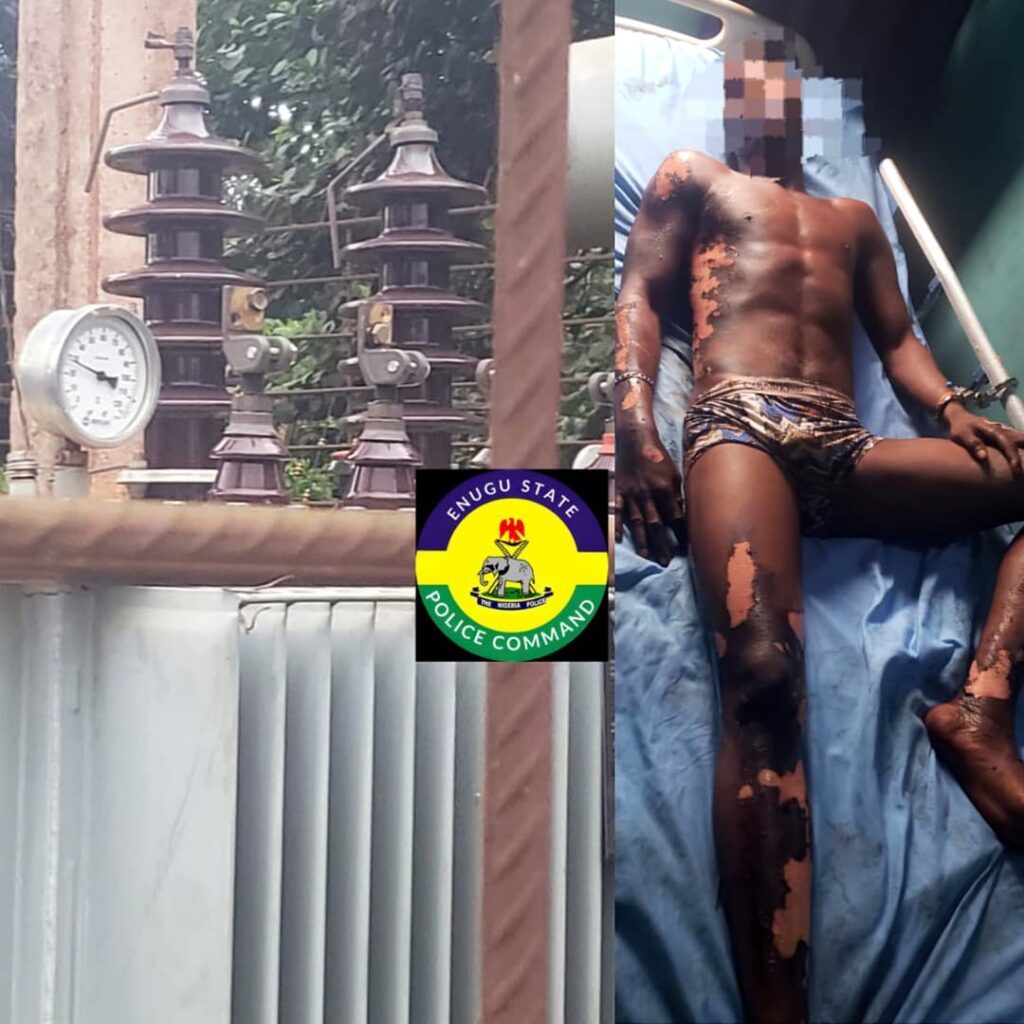Police Arrest 23-Year-Old Suspected Transformer Vandal After Severe Electrocution in Enugu 9 Police Arrest 23-Year-Old Suspected Transformer Vandal After Severe Electrocution in Enugu