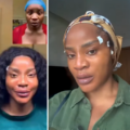 Actress Uche Ogbodo Shares Day One Update After Facial Lift Procedure