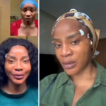 Actress Uche Ogbodo Shares Day One Update After Facial Lift Procedure