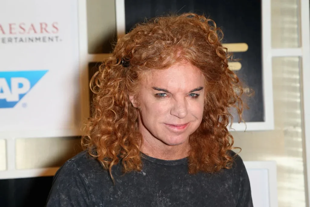 Carrot Top Cancels Las Vegas Shows After Hospitalization 1 Carrot Top Cancels Las Vegas Shows After Hospitalization
